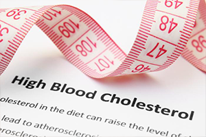 cholesterol check up With Doctor Dr Lebea Medical Practice in Alexandra, Wynberg, Johannesburg, SA